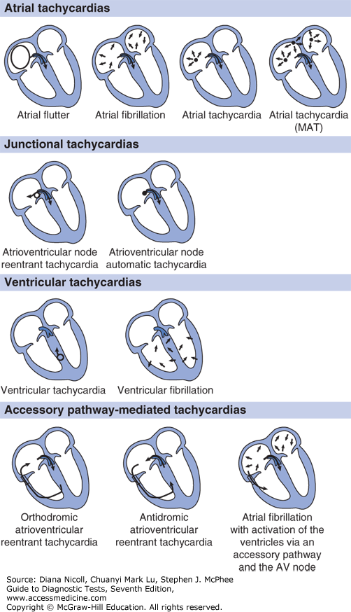 Basic Electrocardiography Guide To Diagnostic Tests