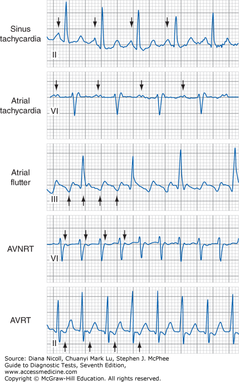 Basic Electrocardiography Guide To Diagnostic Tests