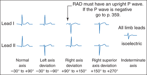 Basic Electrocardiography Guide To Diagnostic Tests